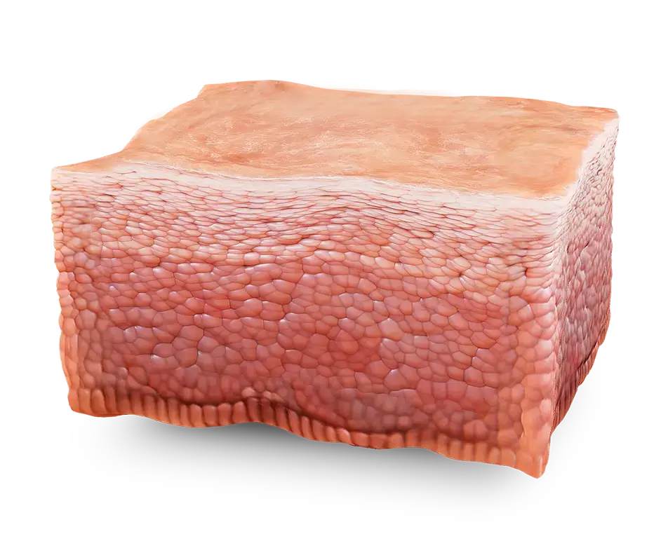 Skin graphic showing a healed wound